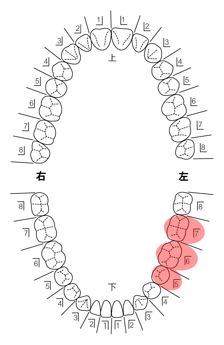 患者さんの希望を伺い治療計画を立てます