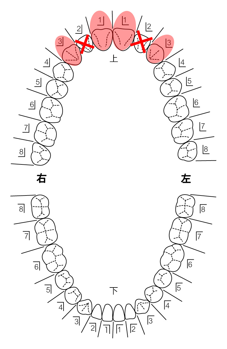 患者さんの希望を伺い治療計画を立てます