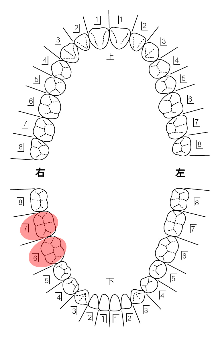 患者さんの希望を伺い治療計画を立てます