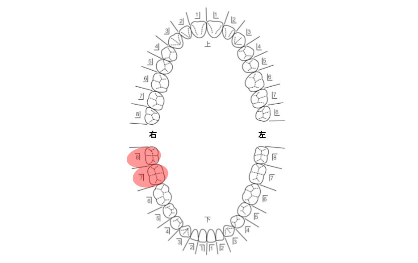 患者さんの希望を伺い治療計画を立てます