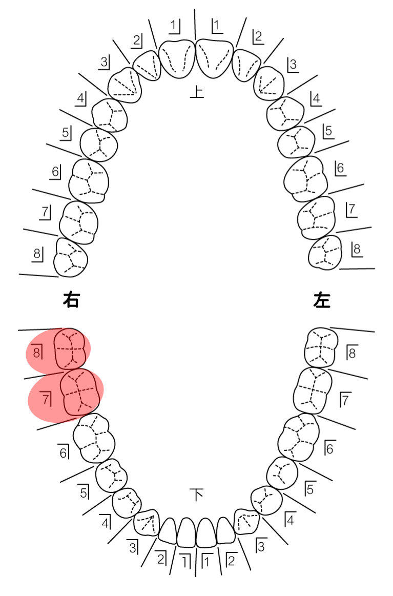 患者さんの希望を伺い治療計画を立てます
