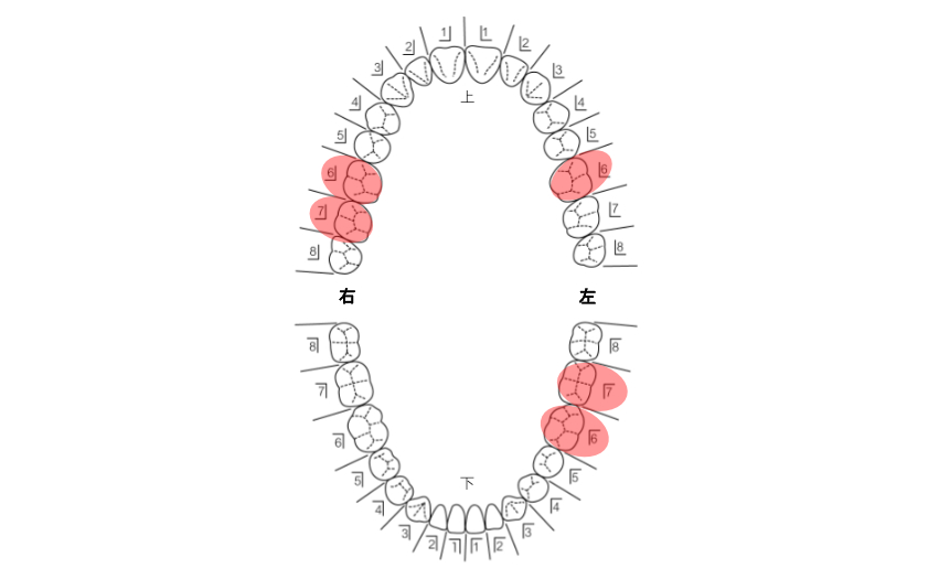 患者さんの希望を伺い治療計画を立てます