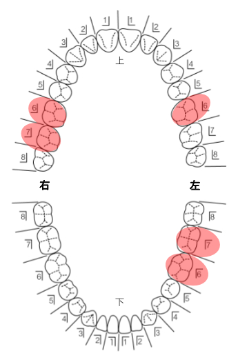 患者さんの希望を伺い治療計画を立てます