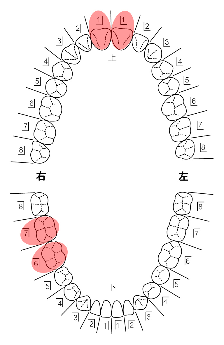 患者さんの希望を伺い治療計画を立てます